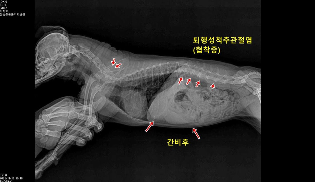 치과 전용 CT·구강 방사선으로 숨은 병변까지 정밀 진단 (퇴행성 척추관절염·간 비후 소견)