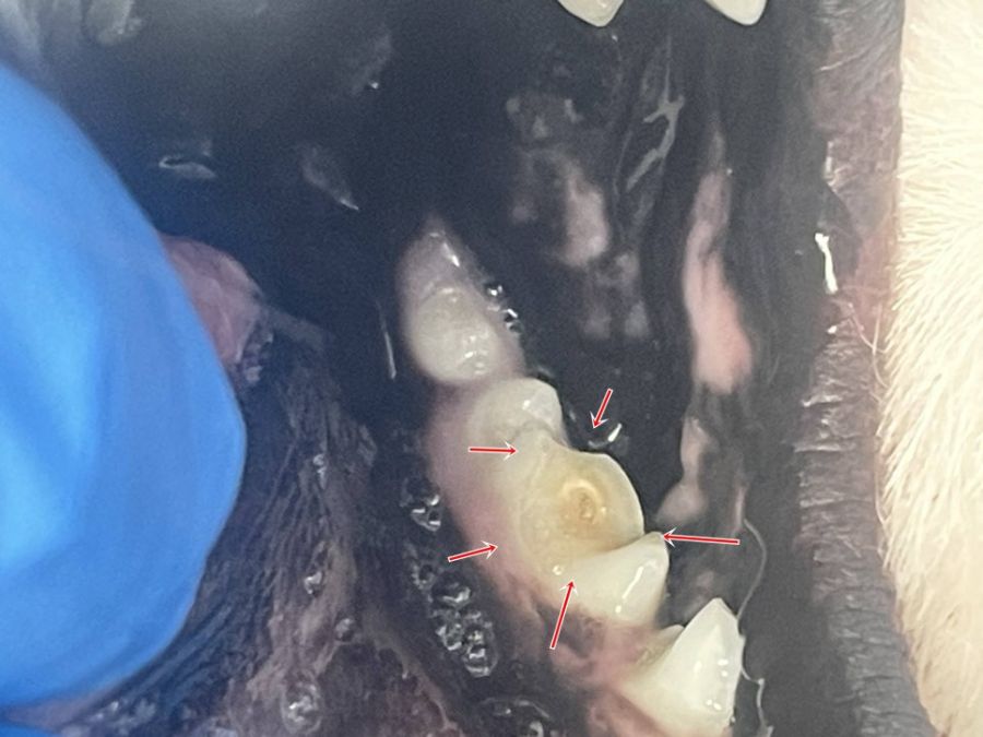 부러져 치수가 드러난 어금니(화살표)