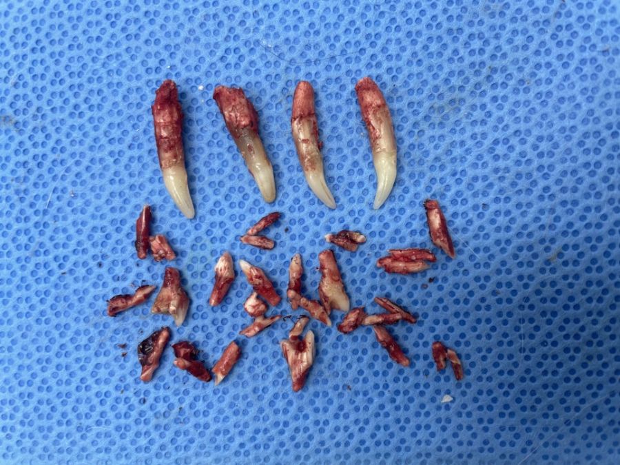 발치 수술 후 제거된 고양이의 송곳니와 작은 치아 조각들