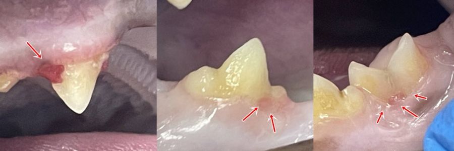 잇몸과 맞닿은 치아 부위에 보이는 붉은 병변(화살표)