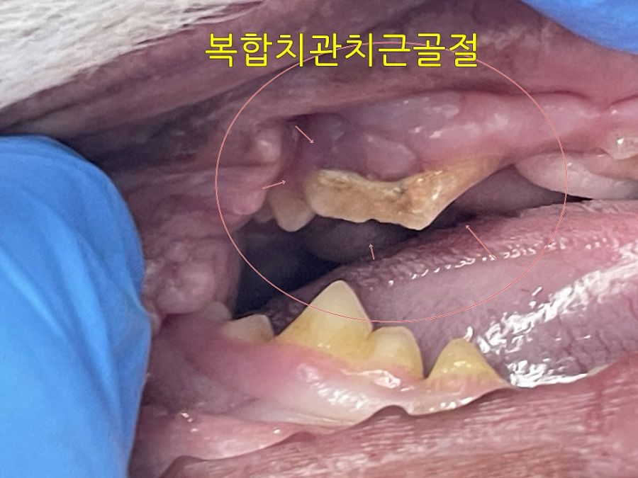 치수가 드러난 채 부러져 있는 호두의 왼쪽 어금니