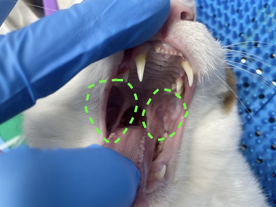 목구멍 주변과 연구개 부위에 보이는 붉은 염증
