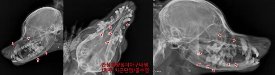 여러 치아 주변의 병변을 화살표로 표시한 방사선 사진