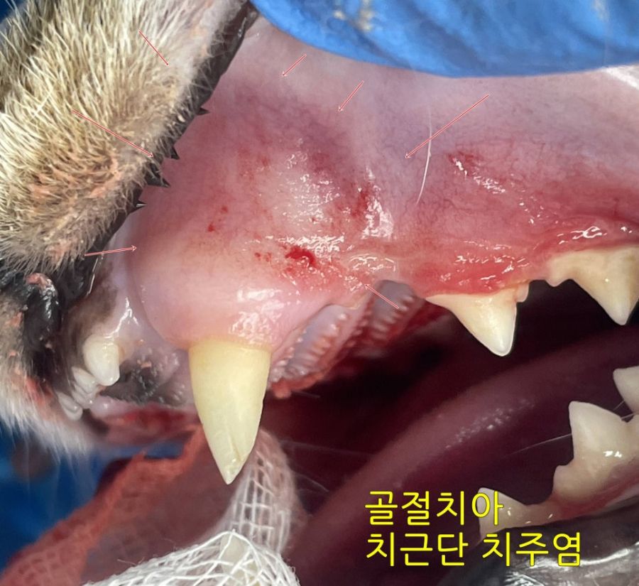 부러진 송곳니 위쪽 잇몸이 붉게 부어 있는 모습