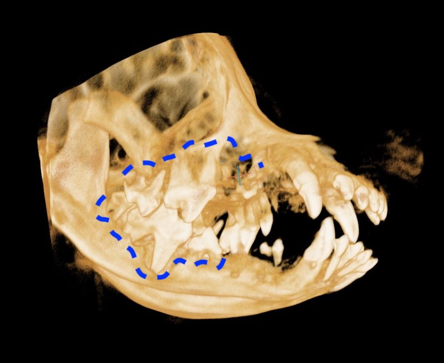 오른쪽 치아의 3D CT 영상. 파란 점선 부위가 문제가 확인된 어금니 쪽입니다.