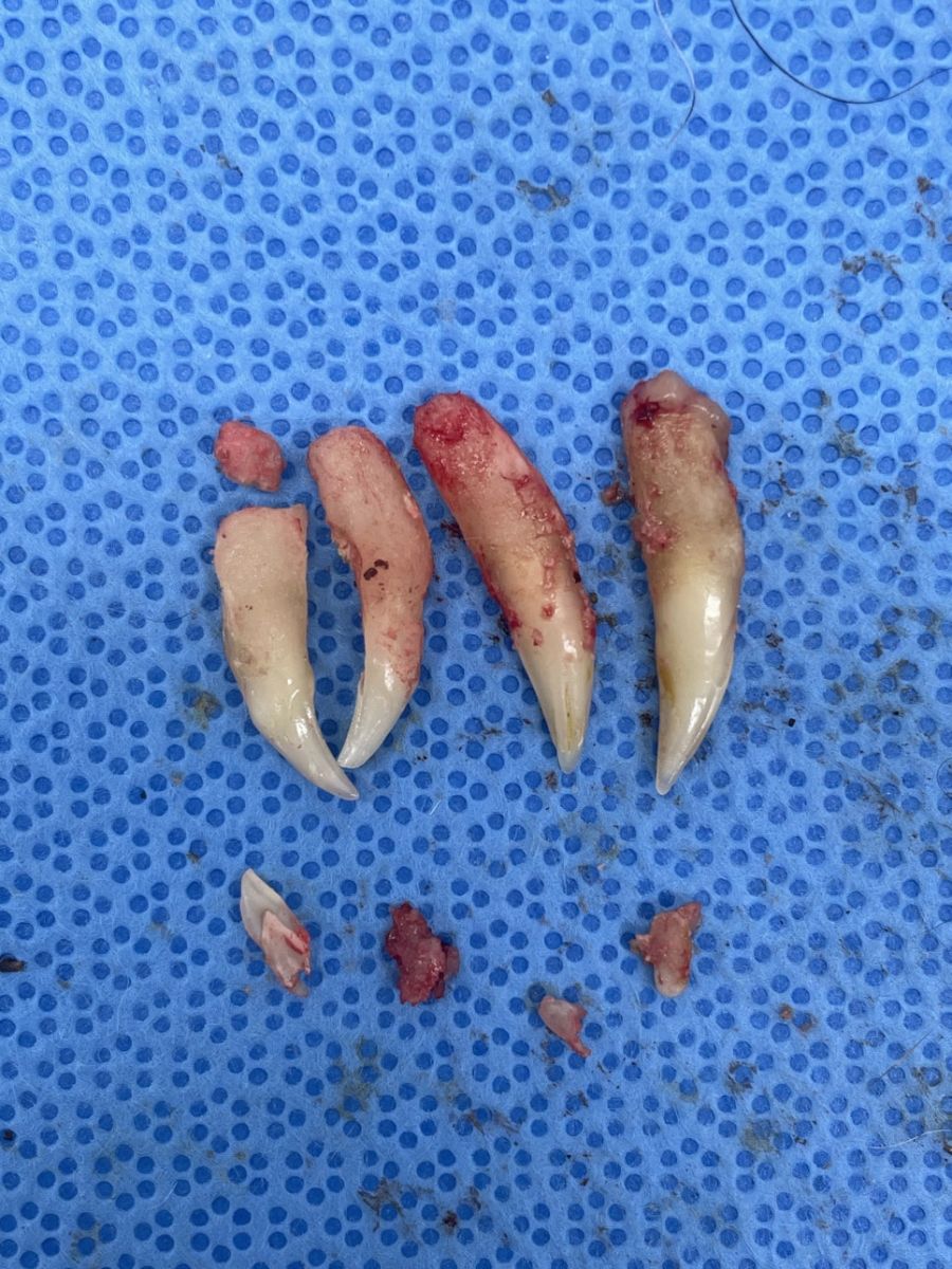 뽑아낸 송곳니 4개와 남아 있던 뿌리 5개입니다.