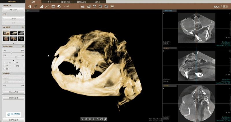 망고의 CBCT 촬영 결과 화면
